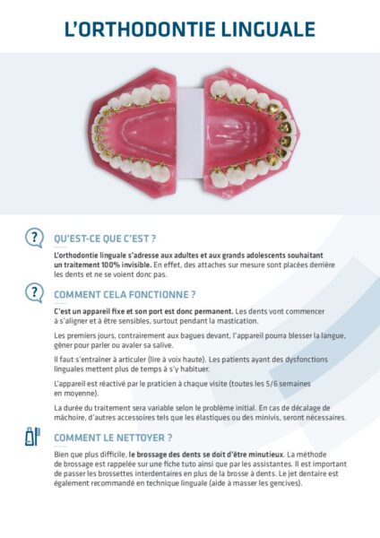 thumbnail of L orthodontie linguale